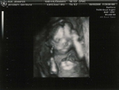 18weeks3dbw