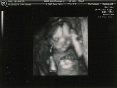 18weeks3dbw